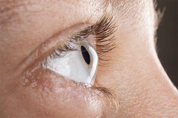 Ceratocone e outras doenças da córnea - clinica